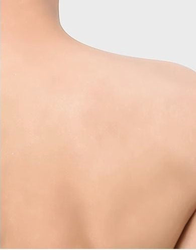 Before and after comparison of long-term use of bath towels on a person's back.